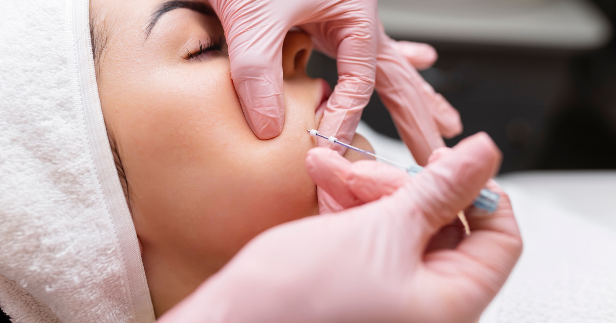 Woman getting PDO threads treatment on her face.